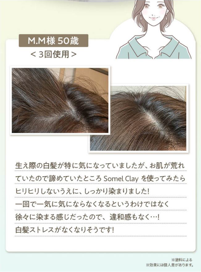 M.M様 50歳 3回使用 分け目の生え際